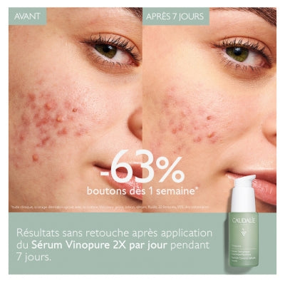 CAUDALIE Vinopure Sérum Anti-Imperfections Salicylique 30 ml
